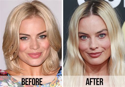 margot robbie before and after surgery|Margot Robbie before and after: The Barbie Plastic Surgery ...